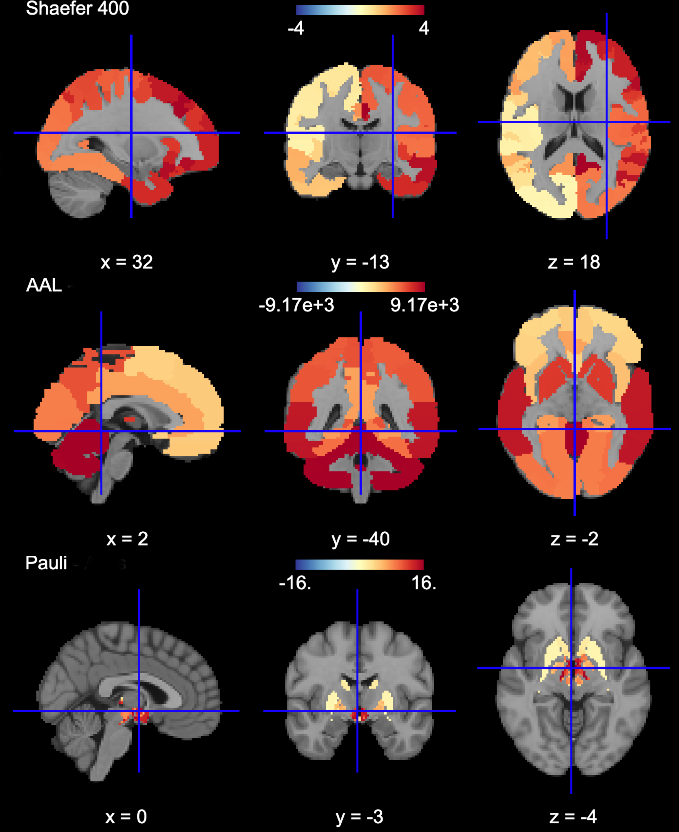 Figure 3: MNI Display of Nilearn's Determinist Atlases (Example).